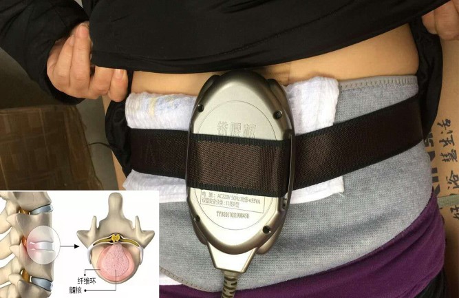 用鐵腰板治療儀有效嗎 用鐵腰板治療儀有效嗎