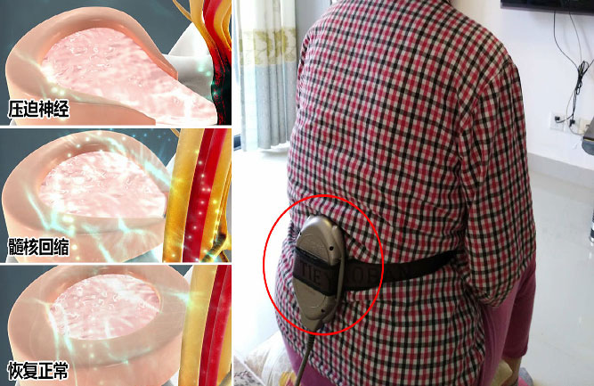 最好的治療方案是保守治療 最好的治療方案是保守治療