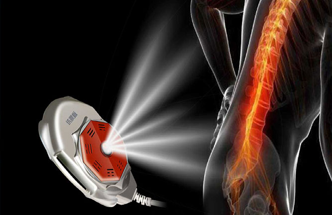 腰間盤突出最好的治療方式 腰間盤突出最好的治療方式g