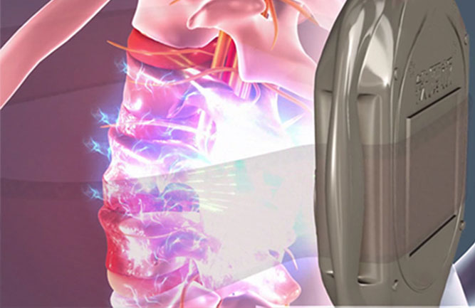 鐵腰板治療效果可信嗎 鐵腰板治療效果可信嗎